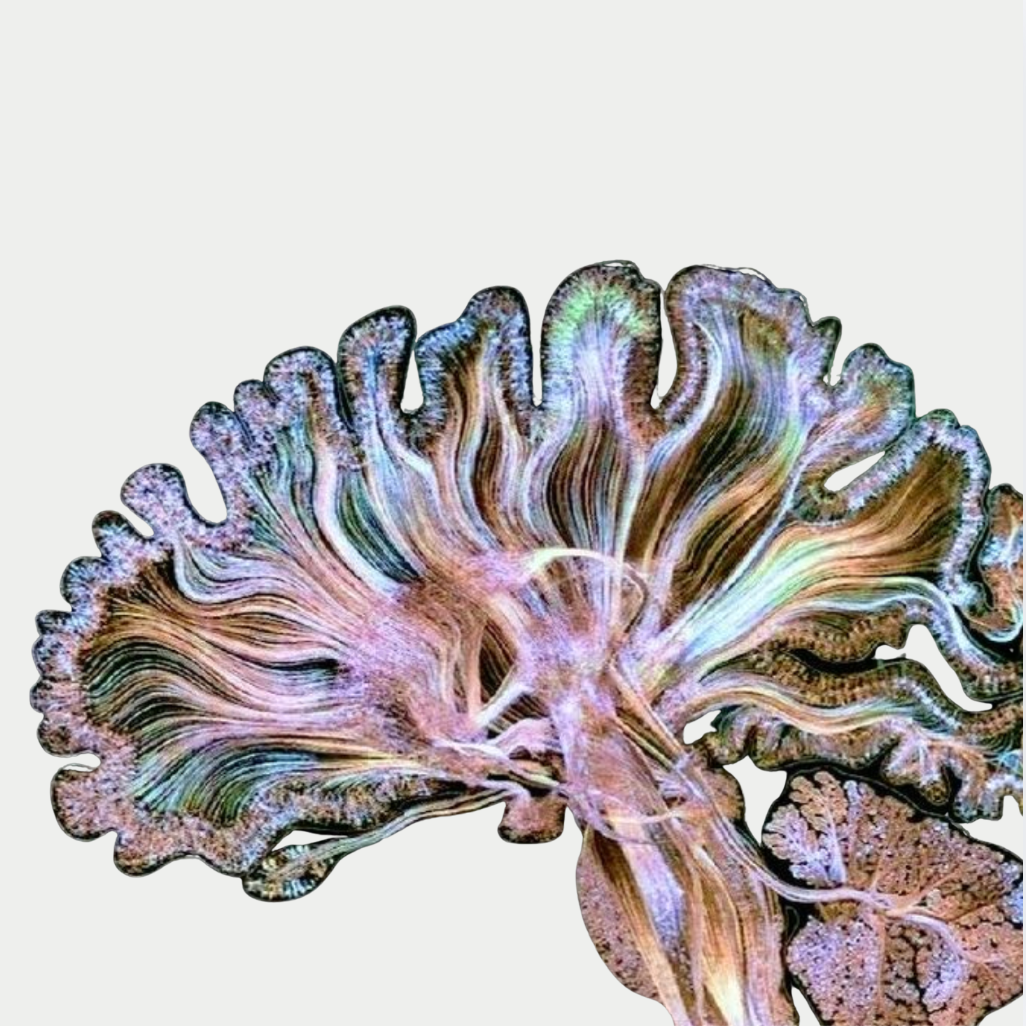 BRAIN OPTIMIZATION