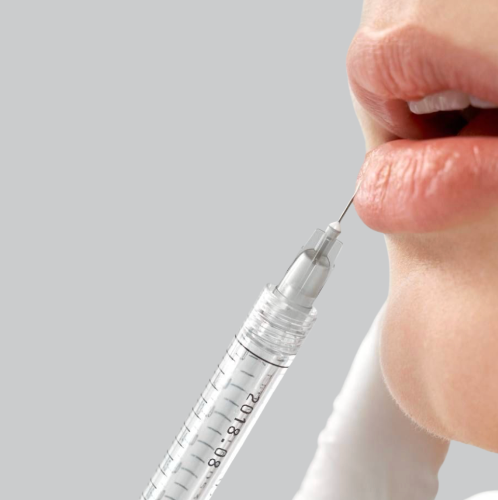 LIP FILLER ENHANCEMENT